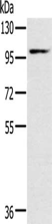 Gel: 6%SDS-PAGE, Lysate: 40 μg, Lane: Mouse heart tissue, Primary antibody: KCNQ5 Antibody(KCNQ5 Antibody) at dilution 1/500, Secondary antibody: Goat anti rabbit IgG at 1/8000 dilution, Exposure time: 1 minute
