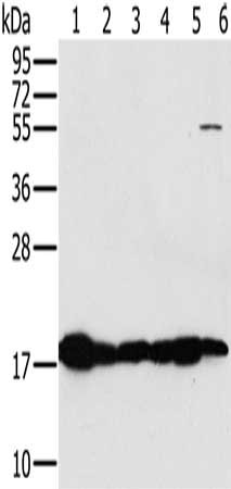 Gel: 10%SDS-PAGE, Lysate: 40 μg, Lane 1-6: Mouse heart tissue, Mouse muscle tissue, hela cells, mouse liver tissue tissue, mouse kidney tissue, hepg2 cells, Primary antibody: MTFP1 Antibody(MTFP1 Antibody) at dilution 1/450, Secondary antibody: Goat anti rabbit IgG at 1/8000 dilution, Exposure time: 5 secondsRabbit anti-Human MTFP1 Polyclonal Antibody