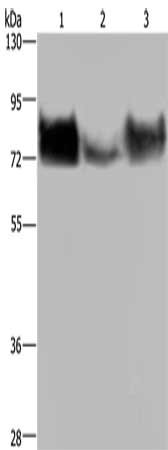 Gel: 6%SDS-PAGE, Lysate: 40 μg, Lane 1-3: HepG2 cells, human testis tissue, Hela cells, Primary antibody: PVR Antibody(PVR Antibody) at dilution 1/200, Secondary antibody: Goat anti rabbit IgG at 1/8000 dilution, Exposure time: 1 minuteRabbit anti-Human PVR Polyclonal Antibody