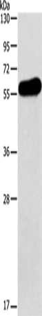 Gel: 10%SDS-PAGE, Lysate: 40 μg, Lane: Human testis tissue, Primary antibody: APOH Antibody(APOH Antibody) at dilution 1/275, Secondary antibody: Goat anti rabbit IgG at 1/8000 dilution, Exposure time: 5 secondsRabbit anti-Human APOH Polyclonal Antibody