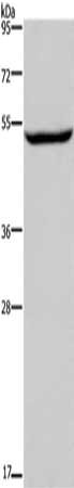 Gel: 8%SDS-PAGE, Lysate: 40 μg, Lane: Raji cells, Primary antibody: IMPDH1 Antibody(IMPDH1 Antibody) at dilution 1/450, Secondary antibody: Goat anti rabbit IgG at 1/8000 dilution, Exposure time: 1 minuteRabbit anti-Human IMPDH1 Polyclonal Antibody