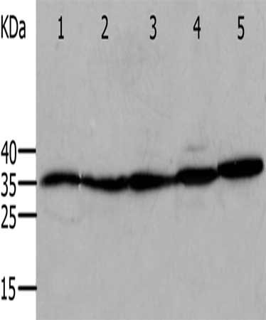 Gel: 12%SDS-PAGE, Lysate: 40 μg, Lane 1-5: Mouse eyes tissue, Mouse heart tissue, Human cervical cancer tissue, OP9 cells, RAW264.7 cells, Primary antibody: ANXA5 Antibody(ANXA5 Antibody) at dilution 1/750, Secondary antibody: Goat anti rabbit IgG at 1/8000 dilution, Exposure time: 1 minuteRabbit anti-Human ANXA5 Polyclonal Antibody