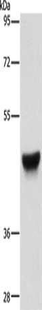Gel: 8%SDS-PAGE, Lysate: 40 μg, Lane: Human esophagus cancer tissue, Primary antibody: KRT13 Antibody(KRT13 Antibody) at dilution 1/500, Secondary antibody: Goat anti rabbit IgG at 1/8000 dilution, Exposure time: 40 seconds