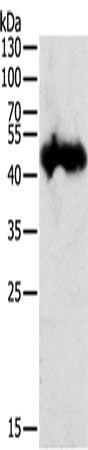 Gel: 12%SDS-PAGE, Lysate: 50 μg, Lane: 823 cells, Primary antibody: PGC Antibody(PGC Antibody) at dilution 1/300, Secondary antibody: Goat anti rabbit IgG at 1/8000 dilution, Exposure time: 30 secondsRabbit anti-Human PGC Polyclonal Antibody
