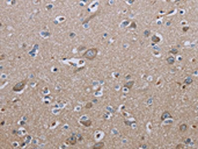 The image on the left is immunohistochemistry of paraffin-embedded Human brain  tissue using IL27RA Antibody(IL27RA Antibody) at dilution 1/40, on the right is treated with fusion protein. (Original magnification: ×200)Rabbit anti-Human IL27RA Polyclonal Antibody