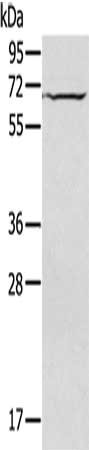 Gel: 8%SDS-PAGE, Lysate: 50 μg, Lane: Jurkat cells, Primary antibody: IL27RA Antibody(IL27RA Antibody) at dilution 1/200, Secondary antibody: Goat anti rabbit IgG at 1/8000 dilution, Exposure time: 20 secondsRabbit anti-Human IL27RA Polyclonal Antibody