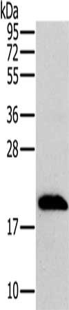 Gel: 10%SDS-PAGE, Lysate: 40 μg, Lane: 293T cells, Primary antibody: MRPL12 Antibody(MRPL12 Antibody) at dilution 1/300, Secondary antibody: Goat anti rabbit IgG at 1/8000 dilution, Exposure time: 5 seconds