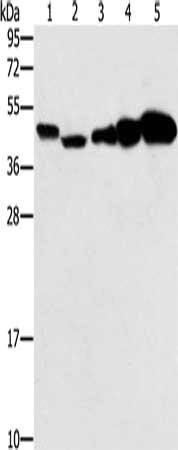 Gel: 10%SDS-PAGE, Lysate: 40 μg, Lane 1-5: Hela cells, Raji cells, Jurkat cells, A549 cells, NIH/3T3 cells, Primary antibody: PPAT Antibody(PPAT Antibody) at dilution 1/250, Secondary antibody: Goat anti rabbit IgG at 1/8000 dilution, Exposure time: 20 secondsRabbit anti-Human PPAT Polyclonal Antibody