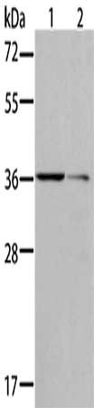 Gel: 10%SDS-PAGE, Lysate: 40 μg, Lane 1-2: Raji cells, Jurkat cells, Primary antibody: AKR1B10 Antibody(AKR1B10 Antibody) at dilution 1/175, Secondary antibody: Goat anti rabbit IgG at 1/8000 dilution, Exposure time: 10 secondsRabbit anti-Human AKR1B10 Polyclonal Antibody
