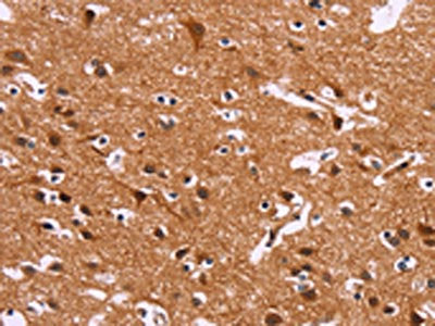 The image on the left is immunohistochemistry of paraffin-embedded Human brain tissue using the antibody Antibody) at dilution 1/30, on the right is treated with fusion protein. (Original magnification: ×200)