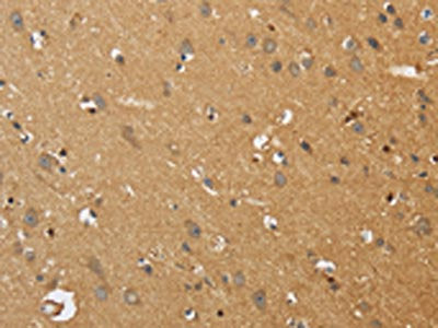 The image on the left is immunohistochemistry of paraffin-embedded Human brain  tissue using EDNRA Antibody(EDNRA Antibody) at dilution 1/30, on the right is treated with synthetic peptide. (Original magnification: ×200)Rabbit anti-Human EDNRA Polyclonal Antibody