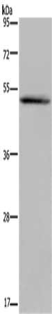 Gel: 8%SDS-PAGE, Lysate: 40 μg, Lane: MCF7 cells, Primary antibody: EDNRA Antibody(EDNRA Antibody) at dilution 1/200, Secondary antibody: Goat anti rabbit IgG at 1/8000 dilution, Exposure time: 5 minutesRabbit anti-Human EDNRA Polyclonal Antibody
