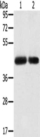 Gel: 8%SDS-PAGE, Lysate: 40 μg, Lane 1-2: PC3 cells, hepg2 cells, Primary antibody: SLC16A3 Antibody(SLC16A3 Antibody) at dilution 1/200, Secondary antibody: Goat anti rabbit IgG at 1/8000 dilution, Exposure time: 2 minutesRabbit anti-Human SLC16A3 Polyclonal Antibody
