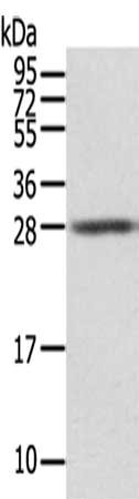 Gel: 12%SDS-PAGE,Lysate: 40 μg,,Primary antibody: STX8 Antibody(STX8 Antibody) at dilution 1/500 dilution,Secondary antibody: Goat anti rabbit IgG at 1/8000 dilution,Exposure time: 5secondsRabbit anti-Human STX8 Polyclonal Antibody