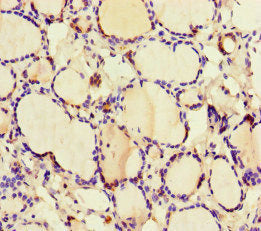 Immunohistochemistry of paraffin-embedded human thyroid tissue using GK Antibody at dilution of 1:100Rabbit anti-Human GK Polyclonal Antibody