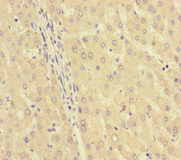 Immunohistochemistry of paraffin-embedded human liver tissue using GK Antibody at dilution of 1:100Rabbit anti-Human GK Polyclonal Antibody