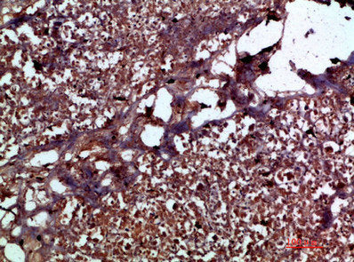 Immunohistochemical analysis of paraffin-embedded human-pancreas, antibody was diluted at 1:200