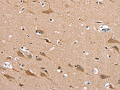 The image on the left is immunohistochemistry of paraffin-embedded Human brain  tissue using MSMB Antibody(MSMB Antibody) at dilution 1/30, on the right is treated with fusion protein. (Original magnification: ×200)Rabbit anti-Human MSMB Polyclonal Antibody