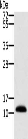 Gel: 10%SDS-PAGE, Lysate: 40 μg, Lane: Human prostate tissue, Primary antibody: MSMB Antibody(MSMB Antibody) at dilution 1/250, Secondary antibody: Goat anti rabbit IgG at 1/8000 dilution, Exposure time: 1 secondRabbit anti-Human MSMB Polyclonal Antibody