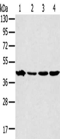 Gel: 8%SDS-PAGE, Lysate: 40 μg, Lane 1-4: Mouse muscle tissue, Jurkat cells, K562 cells, A431 cells, Primary antibody: MAPK12 Antibody(MAPK12 Antibody) at dilution 1/350, Secondary antibody: Goat anti rabbit IgG at 1/8000 dilution, Exposure time: 30 secondsRabbit anti-Human MAPK12 Polyclonal Antibody