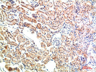 Immunohistochemical analysis of paraffin-embedded Rat Kidney Tissue using IkB α Rabbit pAb diluted at 1:200Rabbit anti-Human NFKBIA Polyclonal Antibody