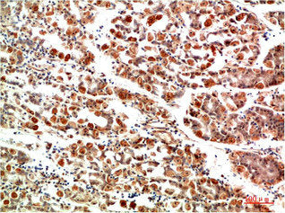Immunohistochemical analysis of paraffin-embedded Human Stomach Tissue using IkB α Rabbit pAb diluted at 1:200Rabbit anti-Human NFKBIA Polyclonal Antibody