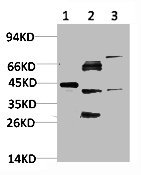 Western blot analysis of 1) Hela Cell Lysate, 2)PC12 Cell Lysate, 3) 3T3 Cell Lysate using IkB α Rabbit pAb diluted at 1:1000.Rabbit anti-Human NFKBIA Polyclonal Antibody