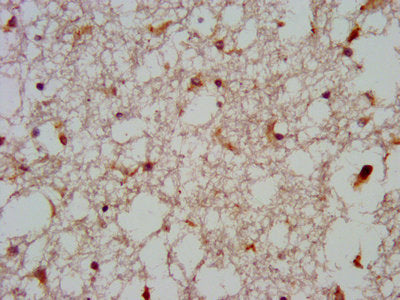 IHC image of GNAS Antibody diluted at 1:600 and staining in paraffin-embedded human brain tissue performed on a Leica BondTM system. After dewaxing and hydration, antigen retrieval was mediated by high pressure in a citrate buffer (pH 6.0). Section was blocked with 10% normal goat serum 30min at RT. Then primary antibody (1% BSA) was incubated at 4°C overnight. The primary is detected by a biotinylated secondary antibody and visualized using an HRP conjugated SP system.Rabbit anti-Human GNAS Polyclonal Antibody