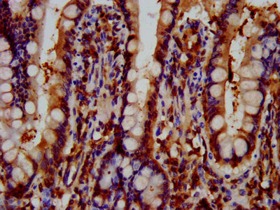 IHC image of GNAS Antibody diluted at 1:600 and staining in paraffin-embedded human small intestine tissue performed on a Leica BondTM system. After dewaxing and hydration, antigen retrieval was mediated by high pressure in a citrate buffer (pH 6.0). Section was blocked with 10% normal goat serum 30min at RT. Then primary antibody (1% BSA) was incubated at 4°C overnight. The primary is detected by a biotinylated secondary antibody and visualized using an HRP conjugated SP system.Rabbit anti-Human GNAS Polyclonal Antibody