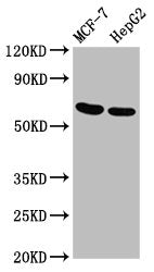 Western Blot  | Positive WB detected in: MCF-7 whole cell lysate, HepG2 whole cell lysate  | All lanes: GNAS antibody at 3.4µg/ml  | Secondary  | Goat polyclonal to rabbit IgG at 1/50000 dilution  | Predicted band size: 68 kDa  | Observed band size: 68 kDaRabbit anti-Human GNAS Polyclonal Antibody