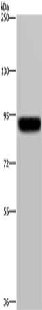 Gel: 6%SDS-PAGE, Lysate: 40 μg, Lane: Hela cells, Primary antibody: PDE4D Antibody(PDE4D Antibody) at dilution 1/200, Secondary antibody: Goat anti rabbit IgG at 1/8000 dilution, Exposure time: 3 minutesRabbit anti-Human PDE4D Polyclonal Antibody