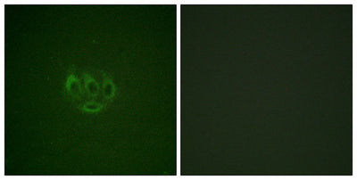 Immunofluorescence staining of methanol-fixed A549 cells using ACK1 (Phospho-Tyr284) Antibody.Rabbit anti-Human TNK2 Polyclonal Antibody