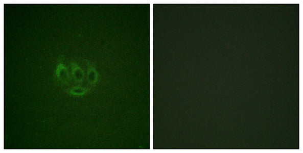 Immunofluorescence staining of methanol-fixed A549 cells using ACK1 (Phospho-Tyr284) Antibody.Rabbit anti-Human TNK2 Polyclonal Antibody