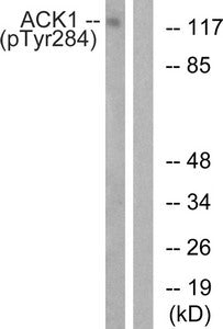 Western blot analysis of extracts from HepG2 cells treated with EGF using ACK1 (Phospho-Tyr284) Antibody.The lane on the right is treated with the antigen-specific peptide.Rabbit anti-Human TNK2 Polyclonal Antibody