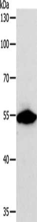 Gel: 10%SDS-PAGE, Lysate: 40 μg, Lane: NIH/3T3 cells, Primary antibody: CALR Antibody(CALR Antibody) at dilution 1/800, Secondary antibody: Goat anti rabbit IgG at 1/8000 dilution, Exposure time: 3 seconds