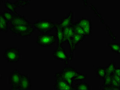 Immunofluorescent analysis of Hela cells using RBMY1A1 Antibody at dilution of 1:100 and Alexa Fluor 488-congugated AffiniPure Goat Anti-Rabbit IgG(H+L)Rabbit anti-Human RBMY1A1 Polyclonal Antibody
