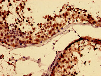 Immunohistochemistry of paraffin-embedded human testis tissue using the antibody at dilution of 1:100Rabbit anti-Human RBMY1A1 Polyclonal Antibody