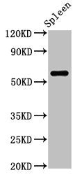 Western Blot  | Positive WB detected in: Rat spleen tissue  | All lanes: RBMY1A1 antibody at 2.5µg/ml  | Secondary  | Goat polyclonal to rabbit IgG at 1/50000 dilution  | Predicted band size: 56, 52, 41 kDa  | Observed band size: 56 kDaRabbit anti-Human RBMY1A1 Polyclonal Antibody