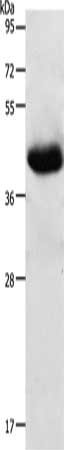 Gel: 10%SDS-PAGE, Lysate: 50 μg, Lane: Mouse heart tissue, Primary antibody: NGFR Antibody(NGFR Antibody) at dilution 1/600, Secondary antibody: Goat anti rabbit IgG at 1/8000 dilution, Exposure time: 20 secondsRabbit anti-Human NGFR Polyclonal Antibody