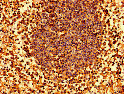 Immunohistochemistry of paraffin-embedded human lymph node tissue using HLA-C Antibody at dilution of 1:100