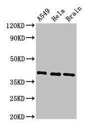 Western Blot  | Positive WB detected in: A549 whole cell lysate, Hela whole cell lysate, Mouse brain tissue  | All lanes: HLA-C antibody at 3.4µg/ml  | Secondary  | Goat polyclonal to rabbit IgG at 1/50000 dilution  | Predicted band size: 41 kDa  | Observed band size: 41 kDa