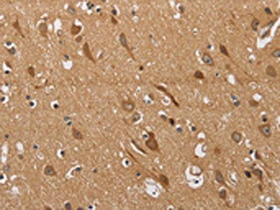 The image on the left is immunohistochemistry of paraffin-embedded Human brain  tissue using KCNQ4 Antibody(KCNQ4 Antibody) at dilution 1/40, on the right is treated with synthetic peptide. (Original magnification: ×200)
