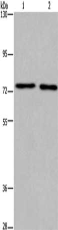 Gel: 6%SDS-PAGE, Lysate: 40 μg, Lane 1-2: Human fetal brain tissue, mouse brain tissue, Primary antibody: KCNQ4 Antibody(KCNQ4 Antibody) at dilution 1/200, Secondary antibody: Goat anti rabbit IgG at 1/8000 dilution, Exposure time: 7 minutes