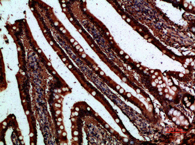 Immunohistochemical analysis of paraffin-embedded human-small-intestine, antibody was diluted at 1:200Rabbit anti-Human FABP2 Polyclonal Antibody
