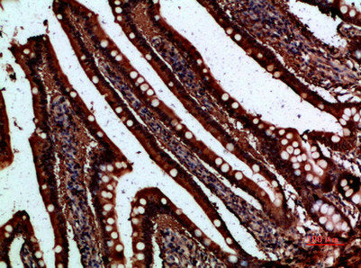 Immunohistochemical analysis of paraffin-embedded human-small-intestine, antibody was diluted at 1:200Rabbit anti-Human FABP2 Polyclonal Antibody