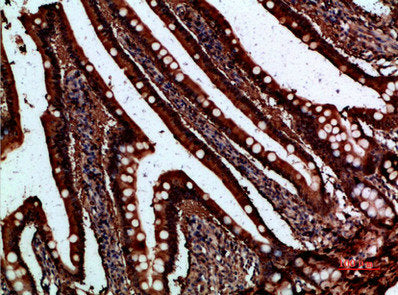 Immunohistochemical analysis of paraffin-embedded human-small-intestine, antibody was diluted at 1:200Rabbit anti-Human FABP2 Polyclonal Antibody