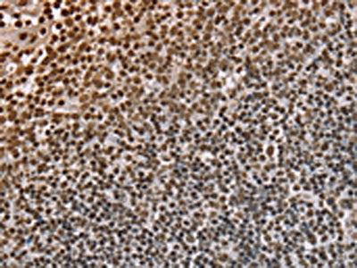 The image on the left is immunohistochemistry of paraffin-embedded Human tonsil tissue using the antibody Antibody) at dilution 1/30, on the right is treated with fusion protein. (Original magnification: ×200)Rabbit anti-Human NUP50 Polyclonal Antibody