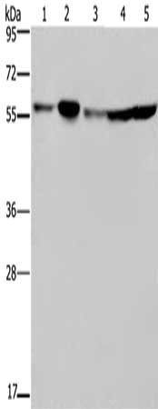 Gel: 8%SDS-PAGE, Lysate: 40 μg, Lane 1-5: Hela cells, 293T cells, A549 cells, HT29 cells, K562 cells, Primary antibody: NUP50 Antibody(NUP50 Antibody) at dilution 1/200, Secondary antibody: Goat anti rabbit IgG at 1/8000 dilution, Exposure time: 20 secondsRabbit anti-Human NUP50 Polyclonal Antibody