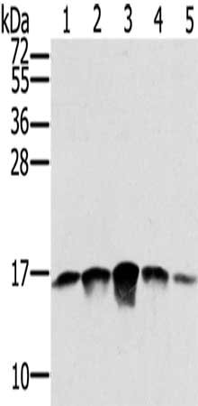 Gel: 12%SDS-PAGE, Lysate: 40 μg, Lane 1-5: PC3 cells, A549 cells, K562 cells, A375 cells, hela cells, Primary antibody: SSBP1 Antibody(SSBP1 Antibody) at dilution 1/400, Secondary antibody: Goat anti rabbit IgG at 1/8000 dilution, Exposure time: 1 minuteRabbit anti-Human SSBP1 Polyclonal Antibody