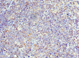 Immunohistochemistry of paraffin-embedded human tonsil tissue using CD6 Antibody at dilution of 1:100Rabbit anti-Human CD6 Polyclonal Antibody